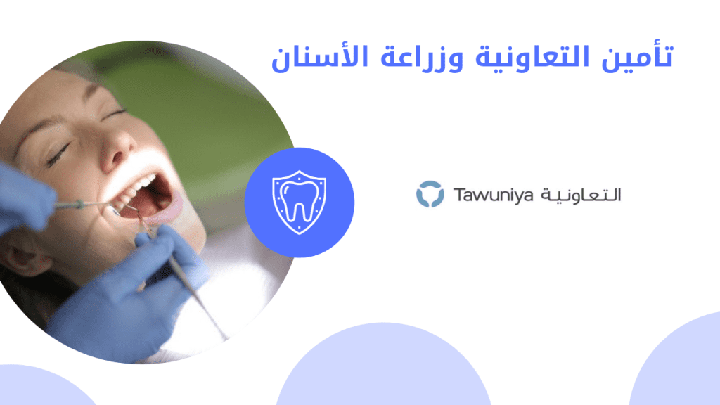 تأمين التعاونية وزراعة الأسنان